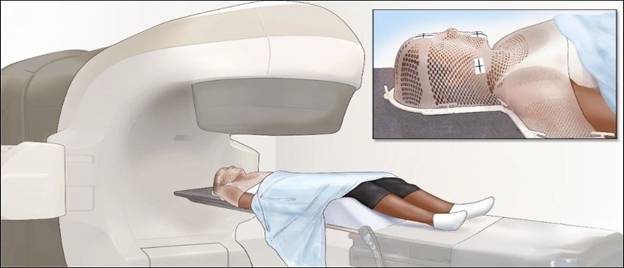 15 t&aacute;c dụng phụ của xạ trị thường gặp ở bệnh nh&acirc;n ung thư