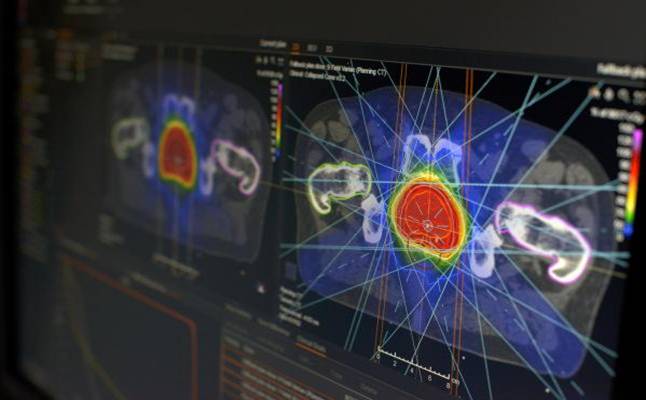 RaySearch Laboraties AB (publ) announces that Yonsei Cancer Center in South Korea has treated its first patient using RayStation and RayCare for carbon ion radiation therapy 