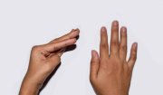 HẠ CALCI MÁU Ở NHỮNG BỆNH NHÂN ĐIỀU TRỊ TUYẾN GIÁP, VÀ NHỮNG ĐIỀU CẦN BIẾT