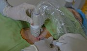 Kỹ thuật chọc hút và tiêm cồn qua da dưới hướng dẫn siêu âm - Giải pháp nhanh, an toàn điều trị nang tuyến giáp lành tính tại Bệnh viện Ung bướu tỉnh Thanh Hóa