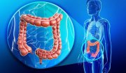 Ung thư đại trực tràng : dấu hiệu nhận biết, các yếu tố nguy cơ, phương pháp chẩn đoán và dự phòng